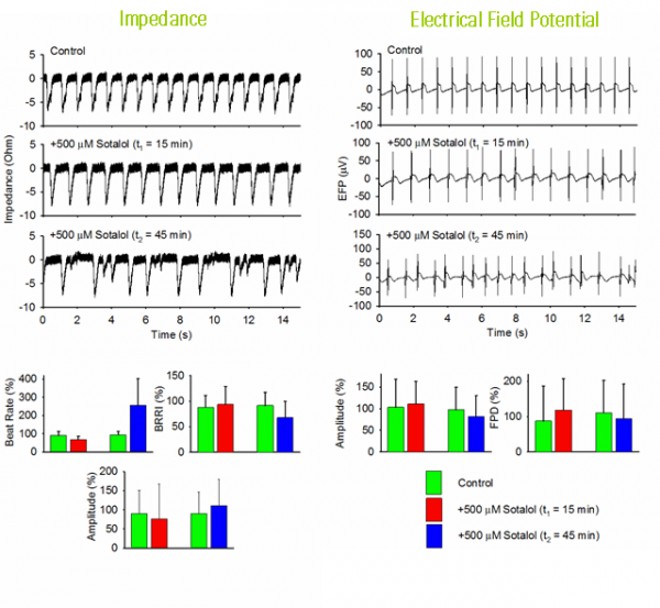 Cardioex1